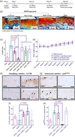 LC3B Antibody in Immunohistochemistry (IHC)