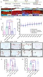 LC3B Antibody in Immunohistochemistry (IHC)