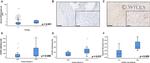 CXCR2 Antibody in Immunohistochemistry (IHC)