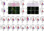 UCP1 Antibody in Immunohistochemistry (IHC)