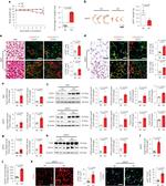 UCP1 Antibody in Western Blot, Immunohistochemistry (WB, IHC)