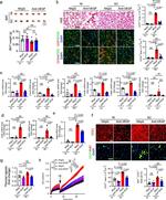 UCP1 Antibody in Immunohistochemistry (IHC)