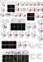 UCP1 Antibody in Immunohistochemistry (IHC)