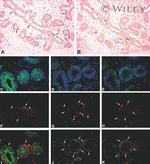 Glucocorticoid Receptor Antibody in Immunohistochemistry (IHC)