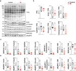 Calsequestrin Antibody in Western Blot (WB)