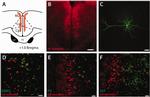 Parvalbumin Antibody in Immunohistochemistry (IHC)