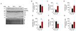 VDAC Antibody in Western Blot (WB)