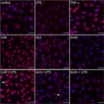 CXCR7 Antibody in Immunocytochemistry (ICC/IF)