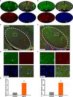 NKp46 Antibody in Immunohistochemistry (IHC)