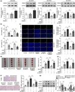 RBM25 Antibody in Western Blot (WB)