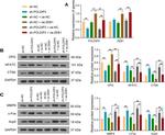 Tartrate Resistant Acid Phosphatase Antibody in Western Blot (WB)