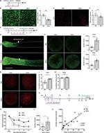 Myeloperoxidase Antibody in Immunohistochemistry (IHC)