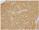 CD20 Antibody in Immunohistochemistry (IHC)