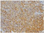 CD20 Antibody in Immunohistochemistry (IHC)