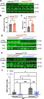 HSL Antibody in Western Blot (WB)