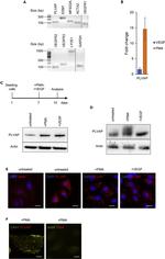 Caveolin 1 Antibody in Immunohistochemistry (IHC)