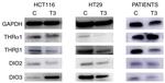 DIO3 Antibody in Western Blot (WB)