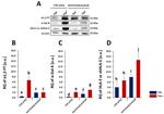 alpha Galactosidase Antibody in Western Blot (WB)