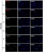 alpha Galactosidase Antibody in Immunocytochemistry (ICC/IF)