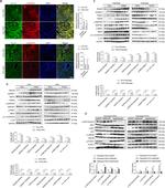 ADAM17 Antibody in Western Blot (WB)