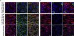 TAGLN Antibody in Immunocytochemistry (ICC/IF)