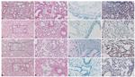 NFkB p65 Antibody in Immunohistochemistry (IHC)