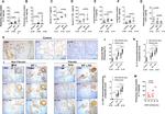 IL-11 Antibody in Immunohistochemistry (IHC)