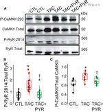 Phospho-CaMKII beta/gamma/delta (Thr287) Antibody in Western Blot (WB)