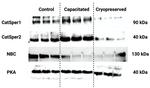 CATSPER2 Antibody in Western Blot (WB)