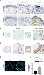 CXCL2 Antibody in Immunohistochemistry (IHC)