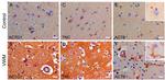 Glutamine Synthetase Antibody in Immunohistochemistry (IHC)