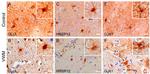 Glutamine Synthetase Antibody in Immunohistochemistry (IHC)