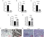 TGFBI Antibody in Immunohistochemistry (IHC)