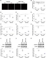 NOX4 Antibody in Western Blot (WB)