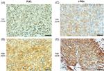 PLK1 Antibody in Immunohistochemistry (IHC)