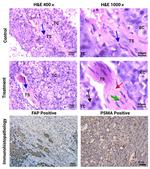 FAP Antibody in Immunohistochemistry (IHC)