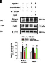 Rabbit IgG (H+L) Secondary Antibody in Western Blot (WB)