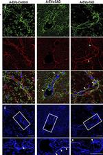 Mouse IgG (H+L) Cross-Adsorbed Secondary Antibody in Immunocytochemistry (ICC/IF)