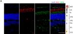 Mouse IgG (H+L) Cross-Adsorbed Secondary Antibody in Immunohistochemistry (IHC)