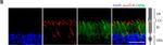 Mouse IgG (H+L) Cross-Adsorbed Secondary Antibody in Immunohistochemistry (IHC)