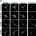 Mouse IgG (H+L) Cross-Adsorbed Secondary Antibody in Immunocytochemistry (ICC/IF)