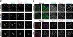 Mouse IgG (H+L) Cross-Adsorbed Secondary Antibody in Immunocytochemistry (ICC/IF)