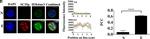 Mouse IgG (H+L) Highly Cross-Adsorbed Secondary Antibody in Immunocytochemistry (ICC/IF)