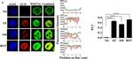 Mouse IgG (H+L) Highly Cross-Adsorbed Secondary Antibody in Immunocytochemistry (ICC/IF)