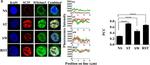 Mouse IgG (H+L) Highly Cross-Adsorbed Secondary Antibody in Immunocytochemistry (ICC/IF)