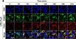 Rabbit IgG (H+L) Cross-Adsorbed Secondary Antibody in Immunocytochemistry (ICC/IF)