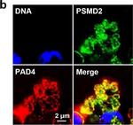 Rabbit IgG (H+L) Cross-Adsorbed Secondary Antibody in Immunocytochemistry (ICC/IF)