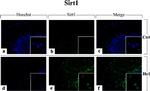 Rabbit IgG (H+L) Cross-Adsorbed Secondary Antibody in Immunocytochemistry (ICC/IF)