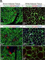 Rabbit IgG (H+L) Highly Cross-Adsorbed Secondary Antibody in Immunohistochemistry (Paraffin) (IHC (P))