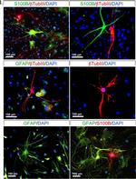 Rabbit IgG (H+L) Cross-Adsorbed Secondary Antibody in Immunocytochemistry (ICC/IF)